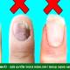 Photo of Harvard doctor reveals signs on fingernails predict longevity