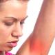 Is armpit itching a warning sign of cancer?